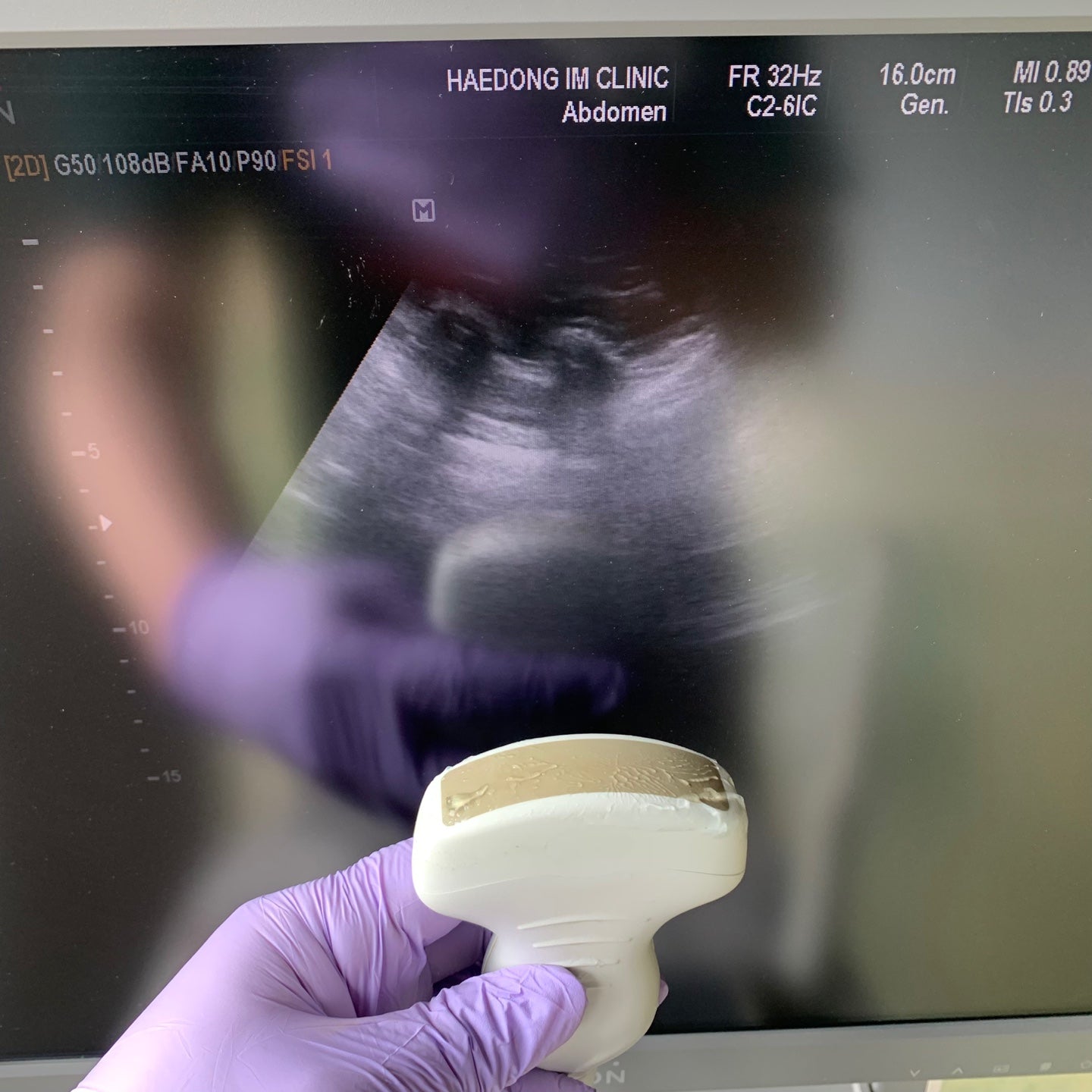 Samsung Medison EKO7 Ultrasound System & Cardiac Sector, Convex Probe - Worldwide