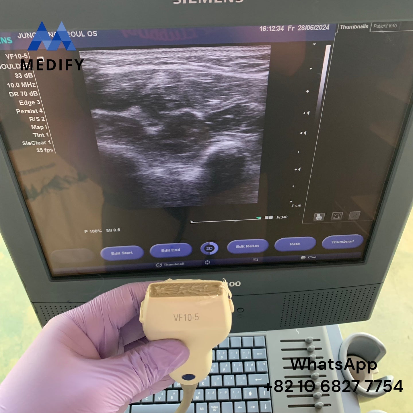 ($900) Siemens Acuson X300 Ultrasound System & Linear Probe - Worldwide