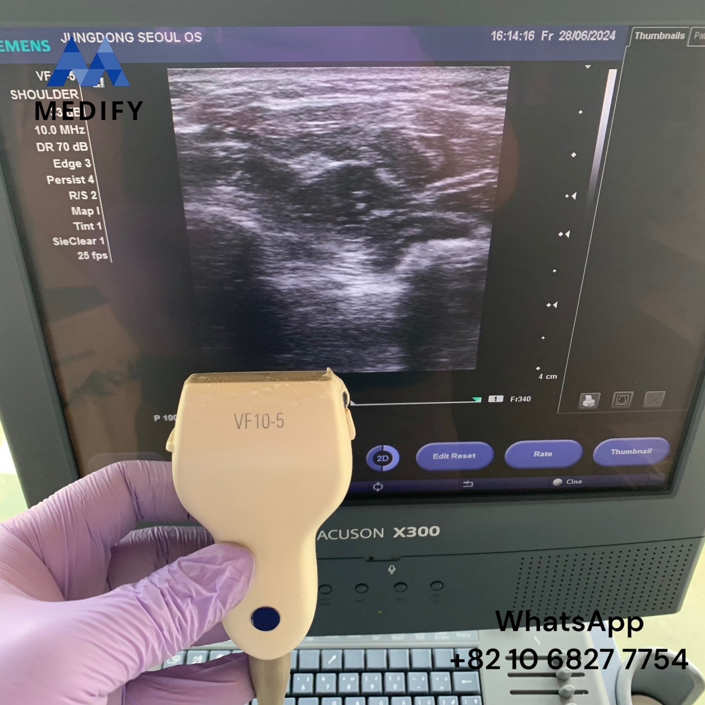 ($900) Siemens Acuson X300 Ultrasound System & Linear Probe - Worldwide