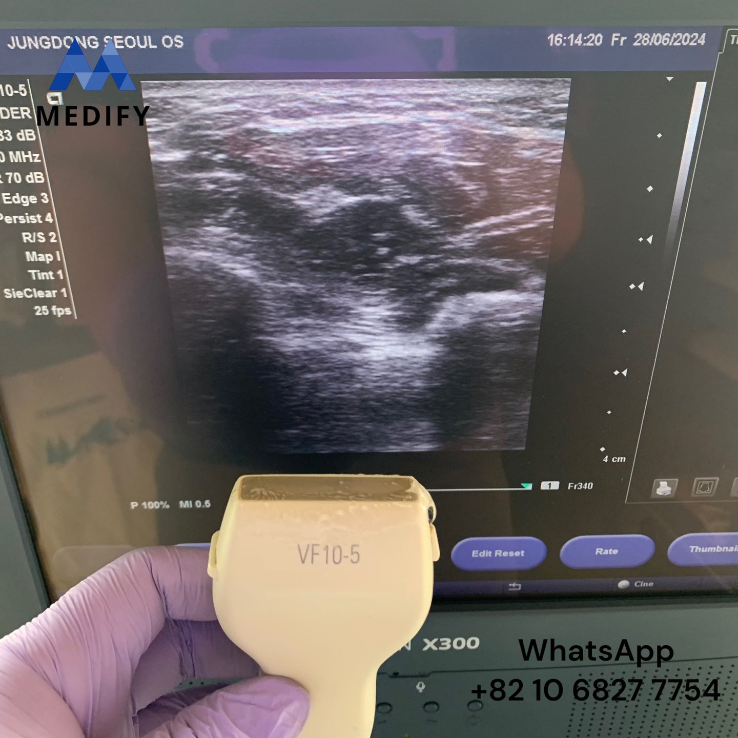 ($900) Siemens Acuson X300 Ultrasound System & Linear Probe - Worldwide