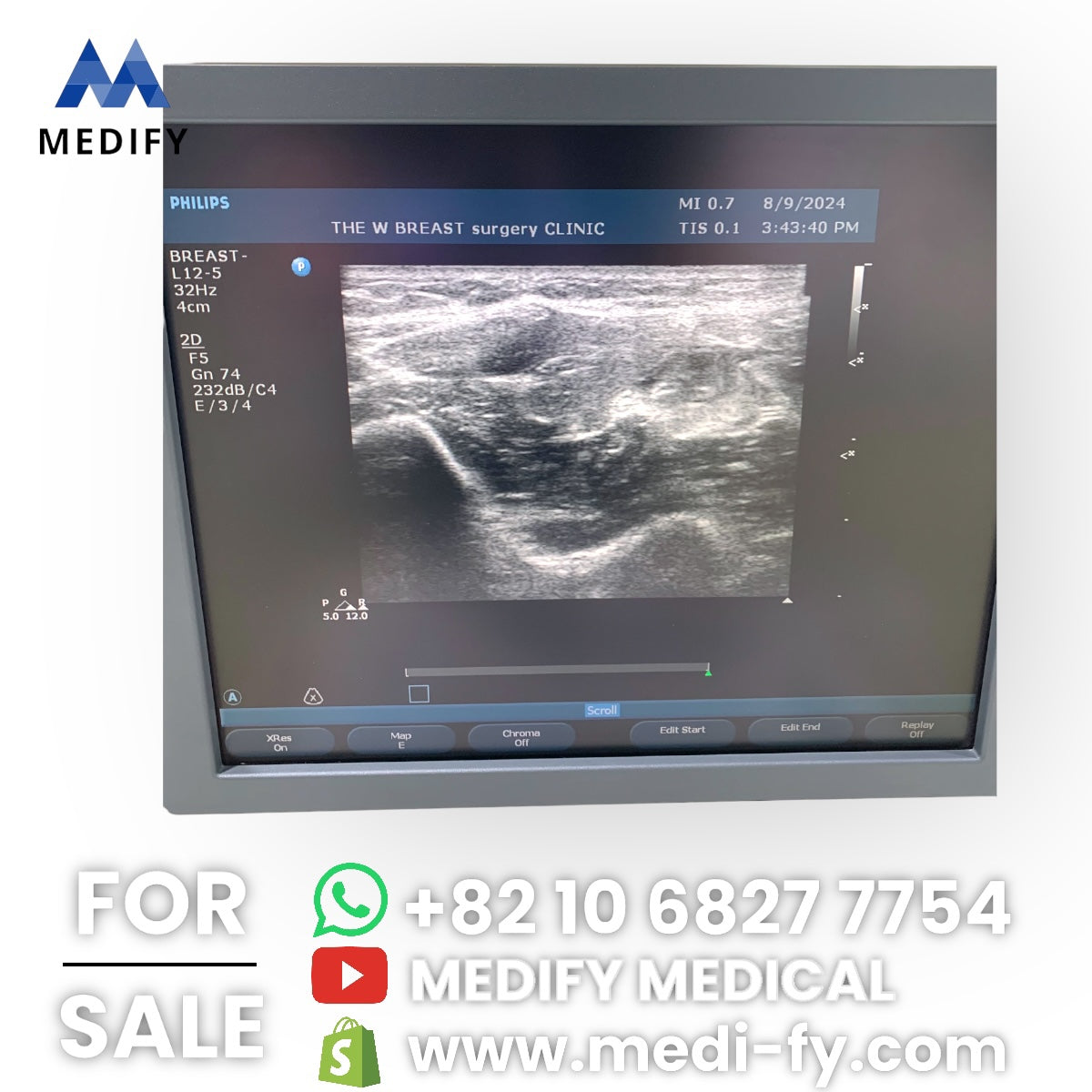Philips HD11XE Ultrasound System & Linear Probe (FOR SALE WORLDWIDE)