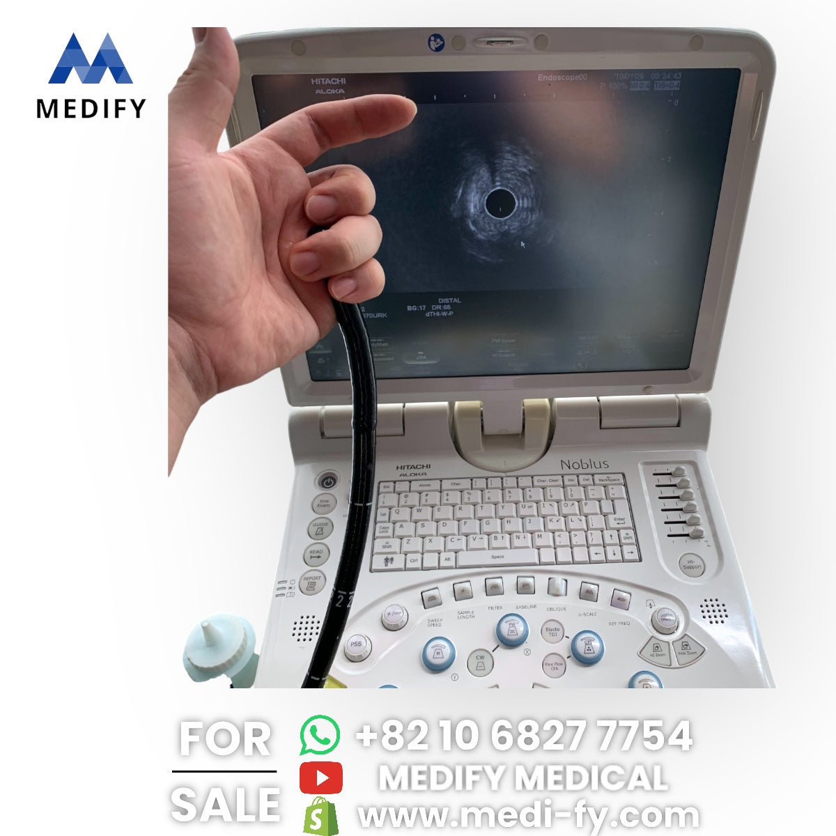Hitachi Aloka Noblus Portable Ultrasound & EG-3670URK Ultrasound Gastroscope