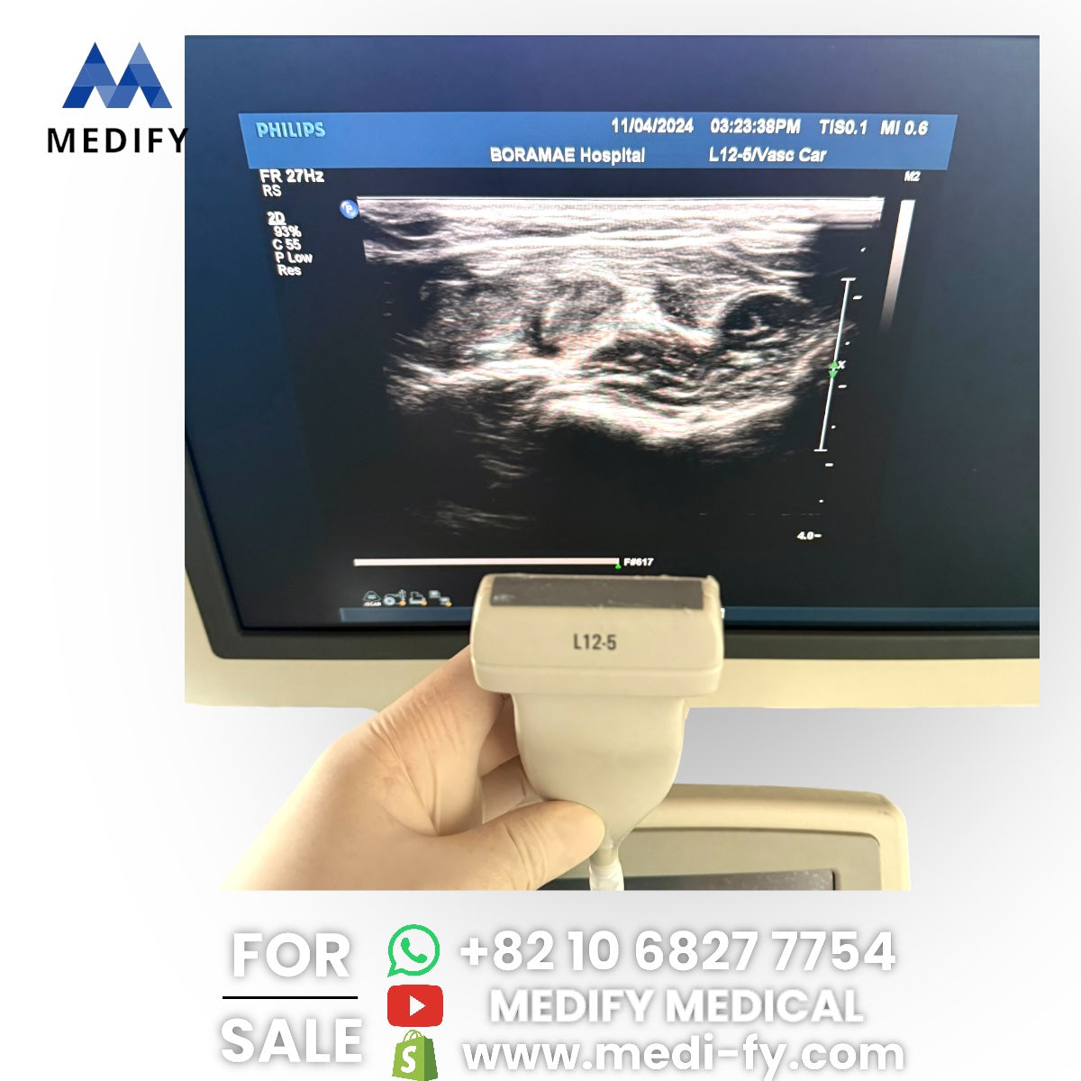 Philips IU22 Ultrasound System & 3Probes 3D Software