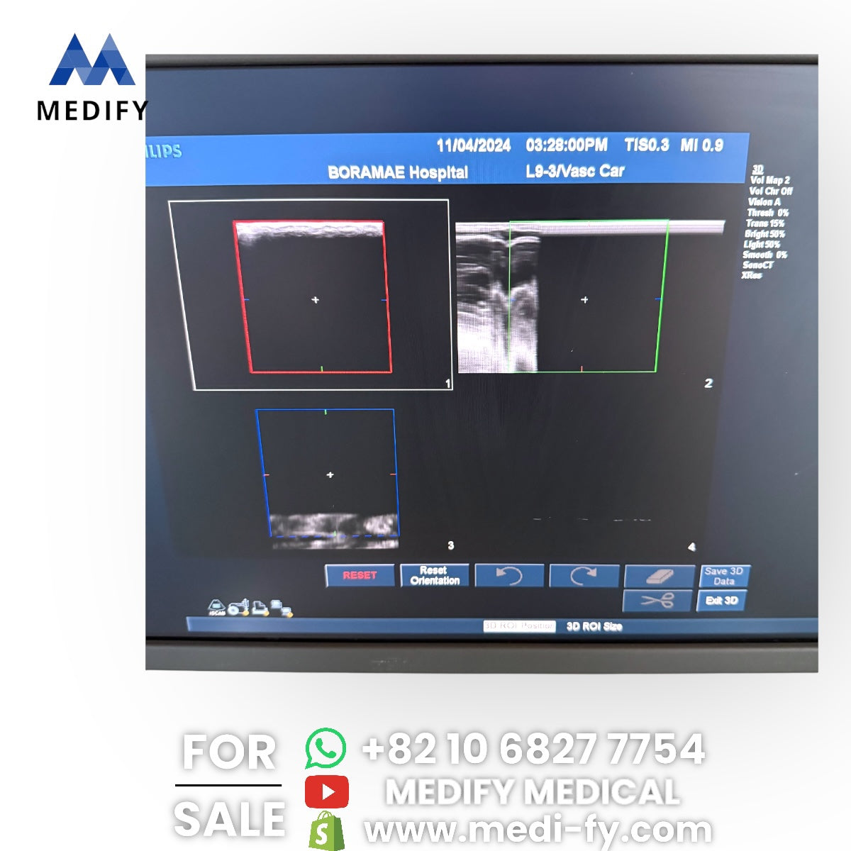Philips IU22 Ultrasound System & 3Probes 3D Software