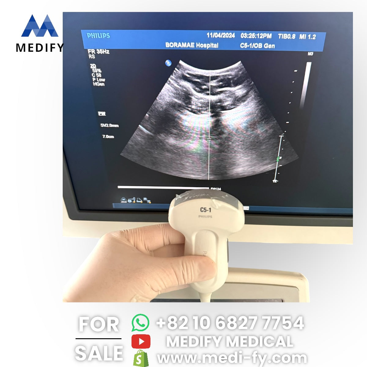 Philips IU22 Ultrasound System & 3Probes 3D Software