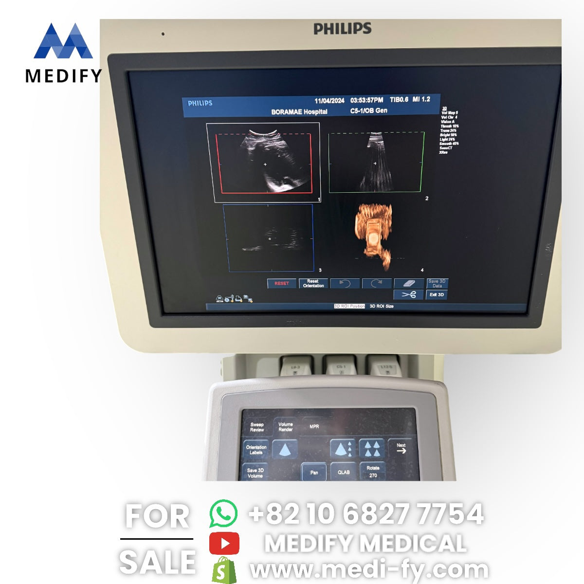 Philips IU22 Ultrasound System & 3Probes 3D Software
