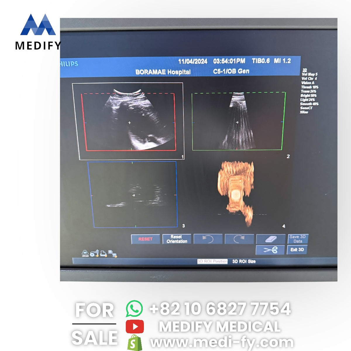 Philips IU22 Ultrasound System & 3Probes 3D Software