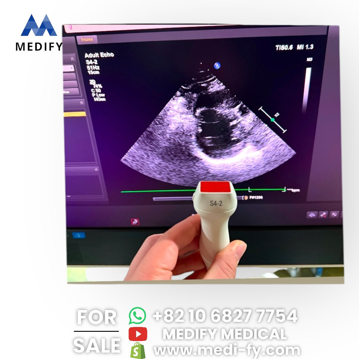 Philips Affiniti 50G Ultrasound System & 3Probes