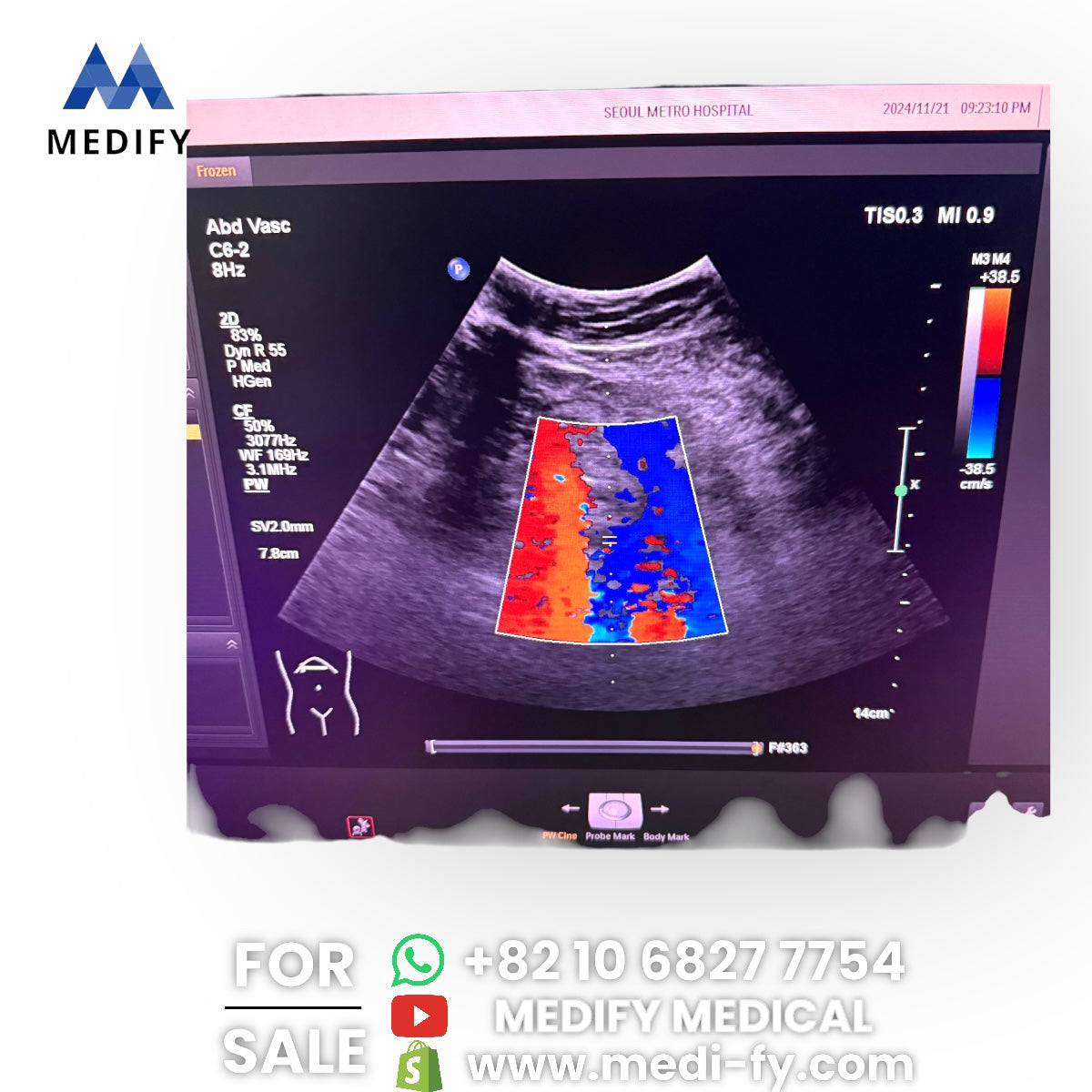 Philips Affiniti 50G Ultrasound System & 3Probes
