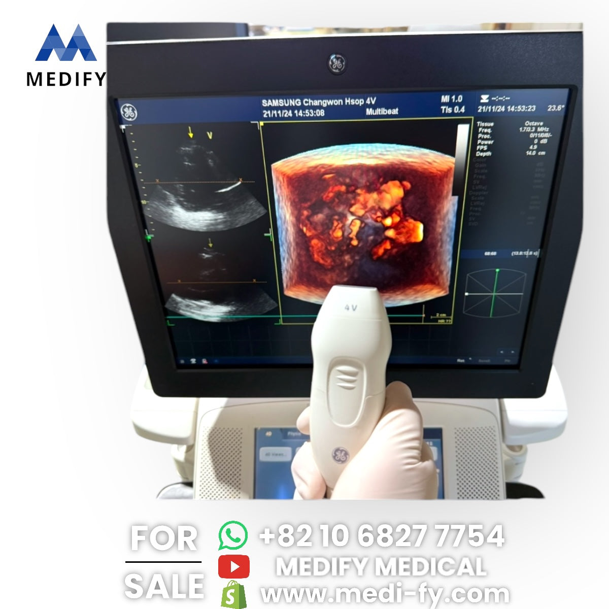 GE Vivid E9 XDclear Ultrasound System 4D Software & 3Probes 4V