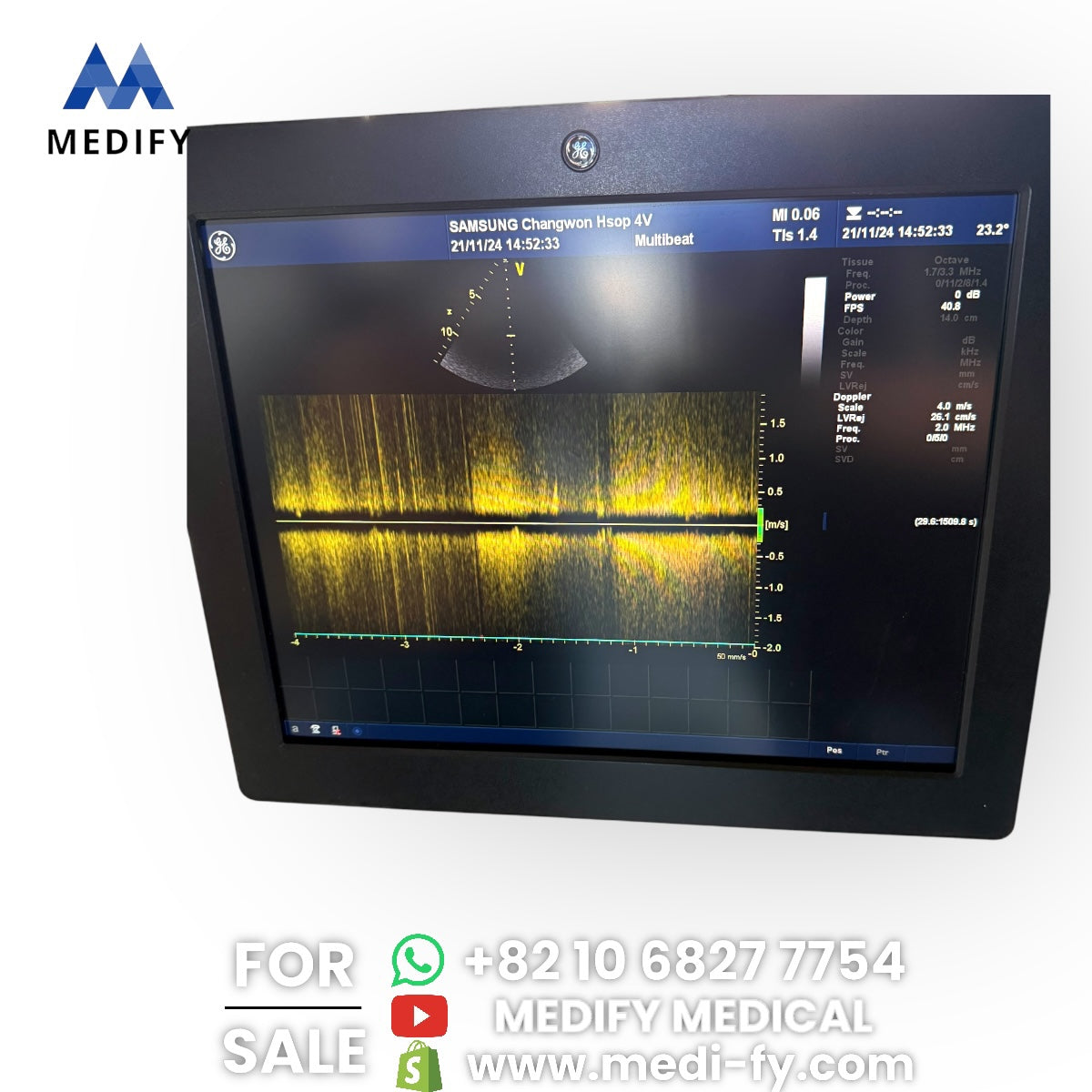 GE Vivid E9 XDclear Ultrasound System 4D Software & 3Probes 4V