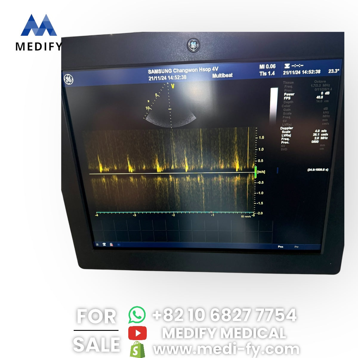 GE Vivid E9 XDclear Ultrasound System 4D Software & 3Probes 4V
