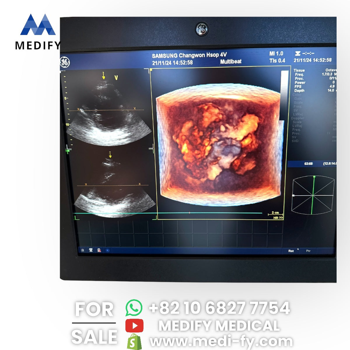 GE Vivid E9 XDclear Ultrasound System 4D Software & 3Probes 4V
