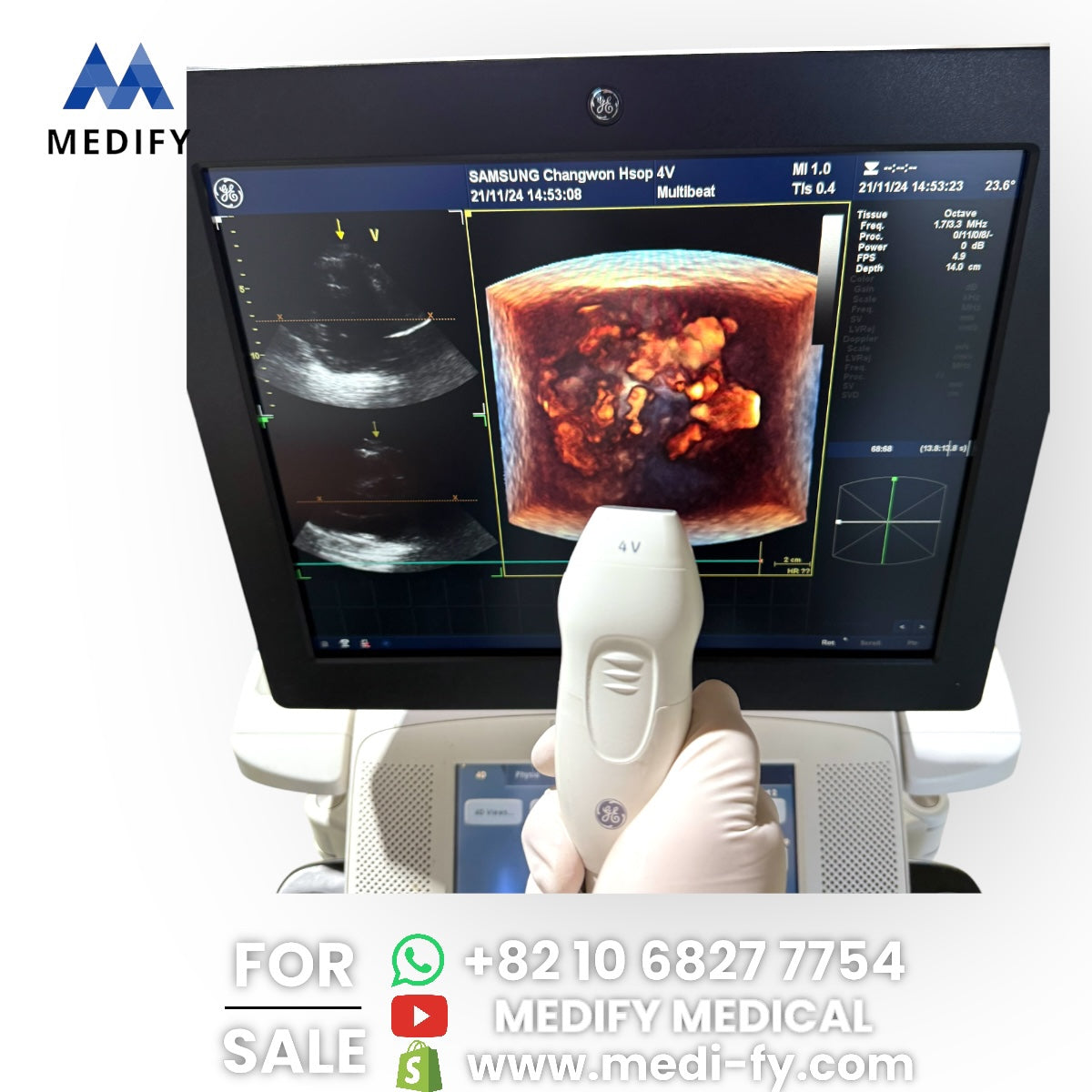 GE Vivid E9 XDclear Ultrasound System 4D Software & 3Probes 4V