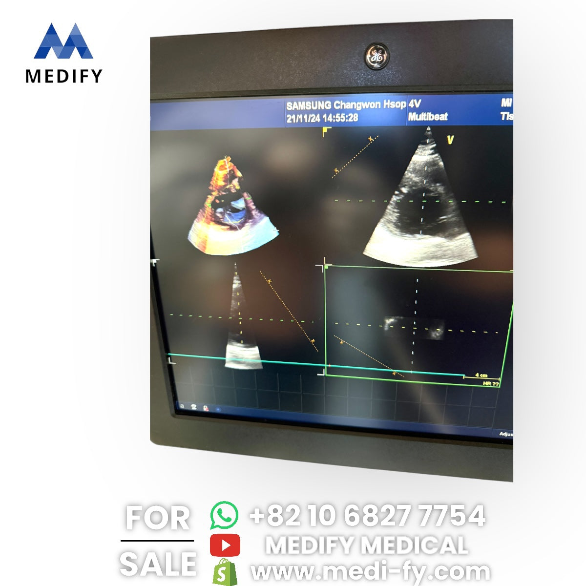 GE Vivid E9 XDclear Ultrasound System 4D Software & 3Probes 4V