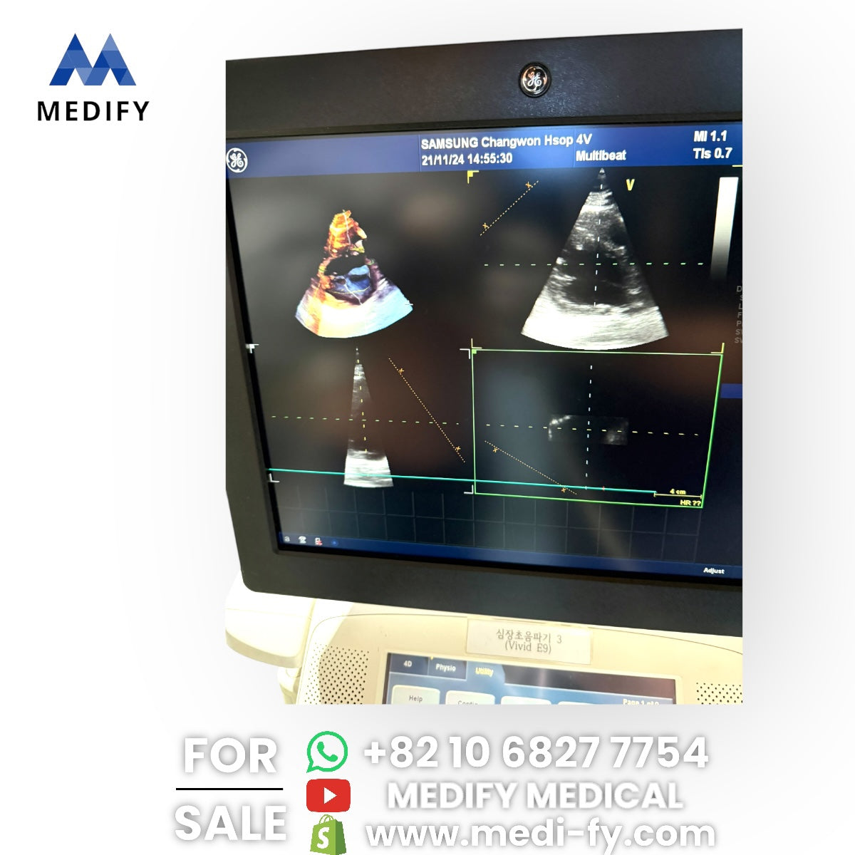 GE Vivid E9 XDclear Ultrasound System 4D Software & 3Probes 4V