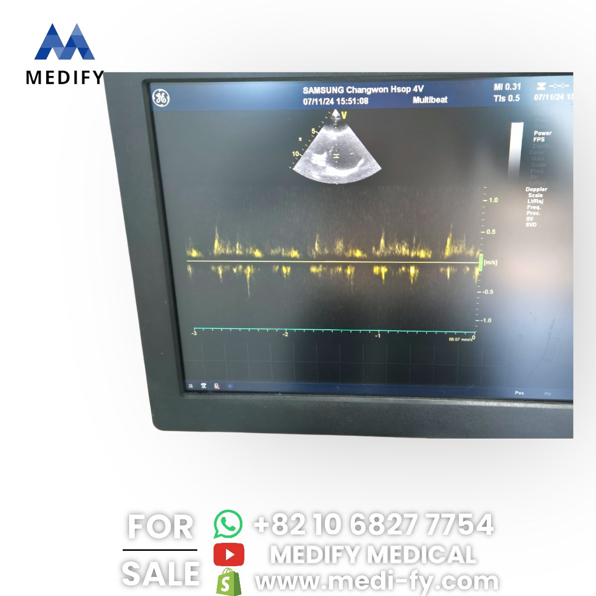 GE Vivid E9 XDclear Ultrasound System 4D Software & 3Probes 4V