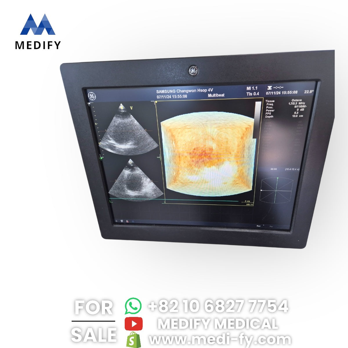 GE Vivid E9 XDclear Ultrasound System 4D Software & 3Probes 4V