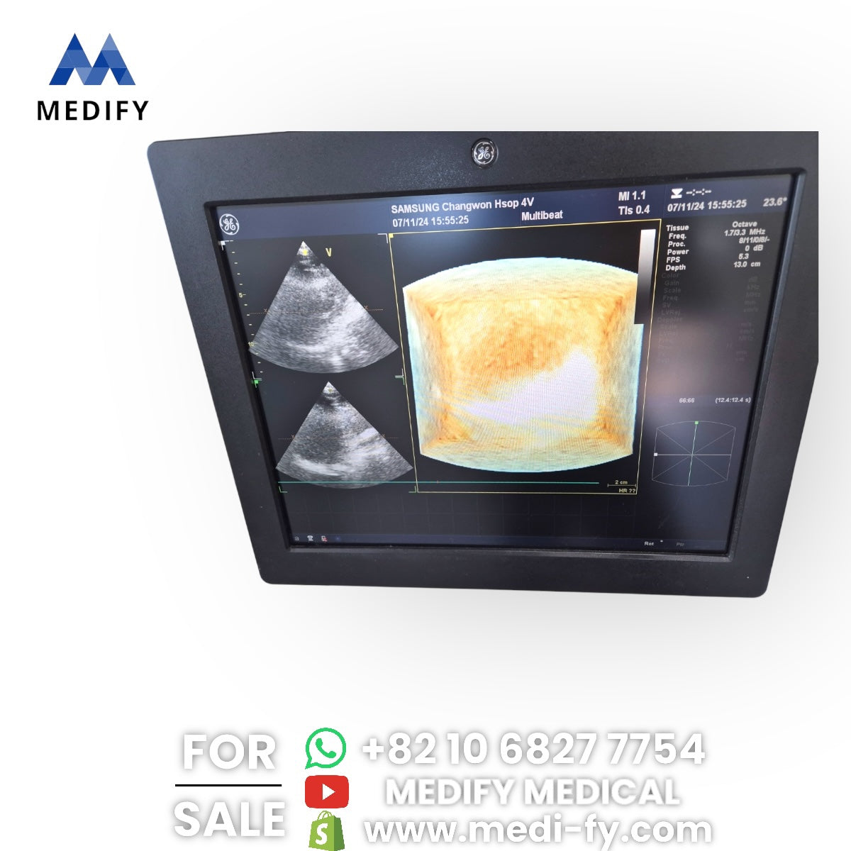 GE Vivid E9 XDclear Ultrasound System 4D Software & 3Probes 4V