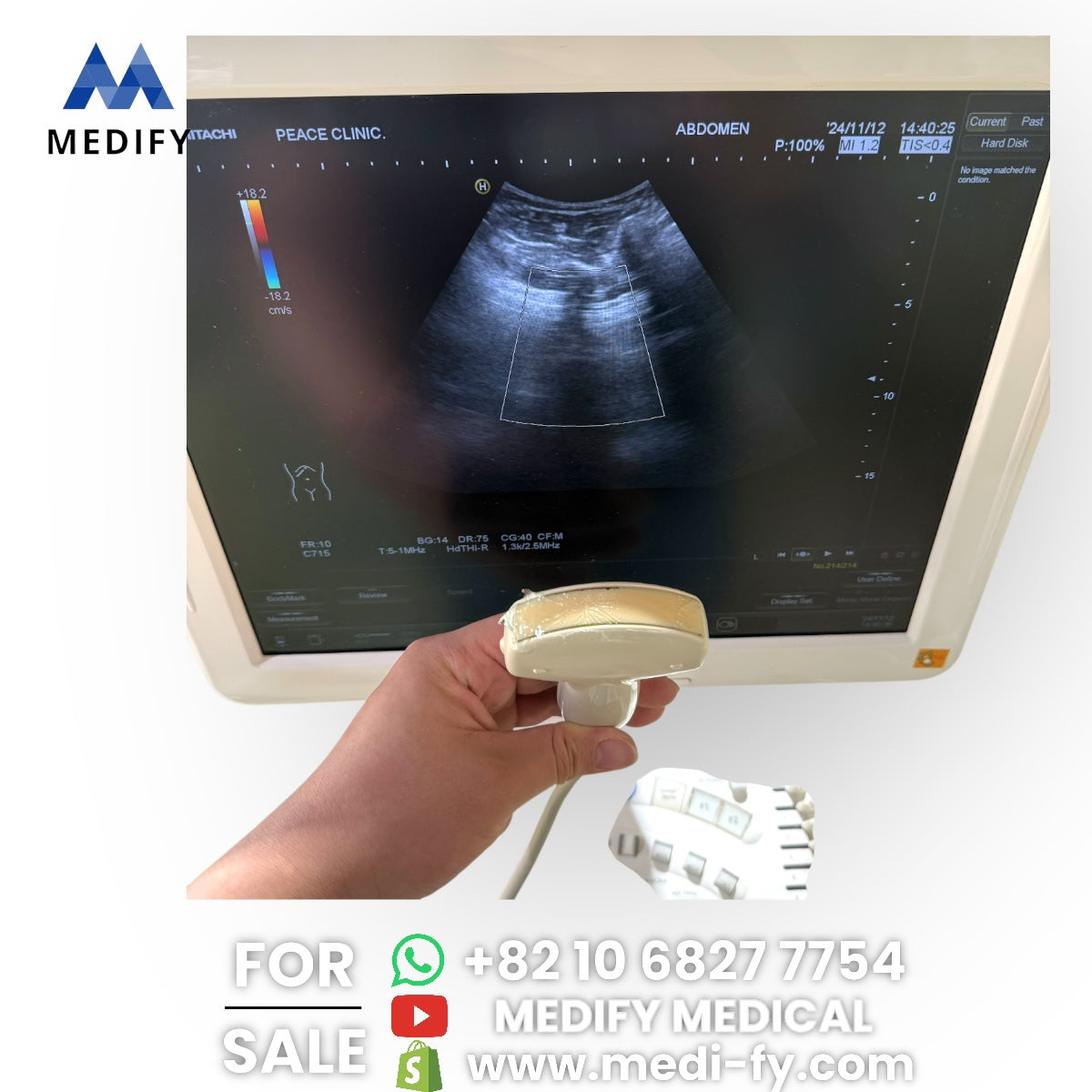 (4,500$) HITACHI Avius HI VISION Ultrasound System & 2Probes