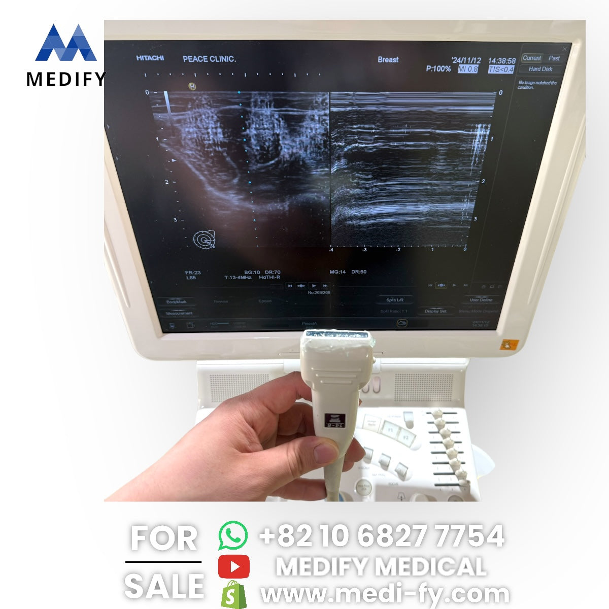 (4,500$) HITACHI Avius HI VISION Ultrasound System & 2Probes