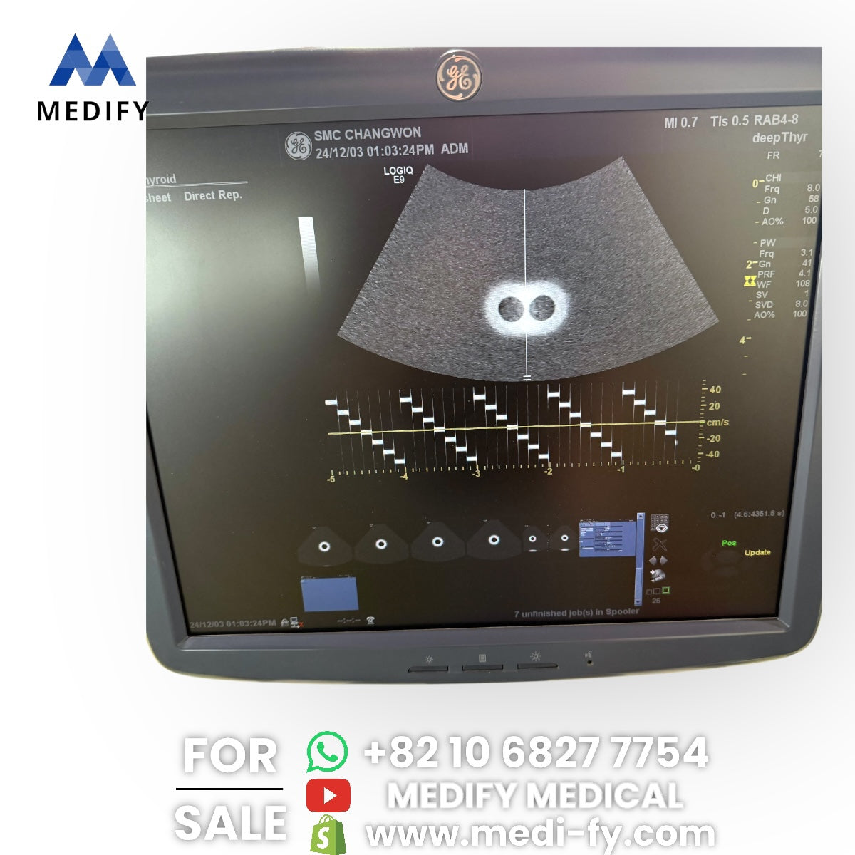 GE Logiq E9 Ultrasound System & 3Probes ( L8-18i, 9L, M4S) 3D/4D Software