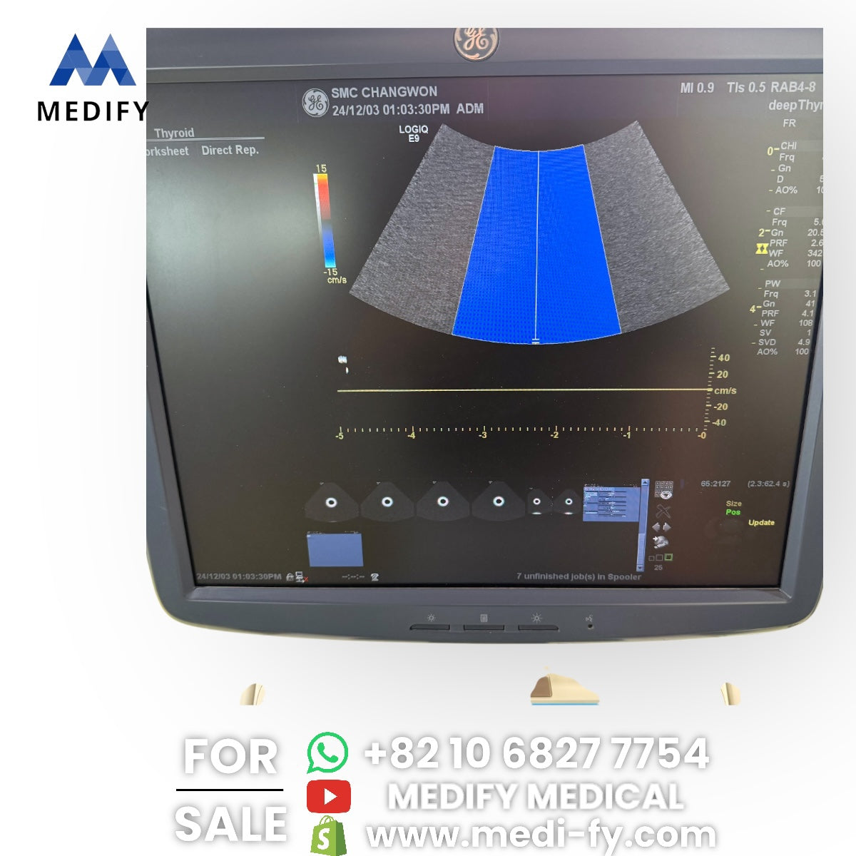 GE Logiq E9 Ultrasound System & 3Probes ( L8-18i, 9L, M4S) 3D/4D Software
