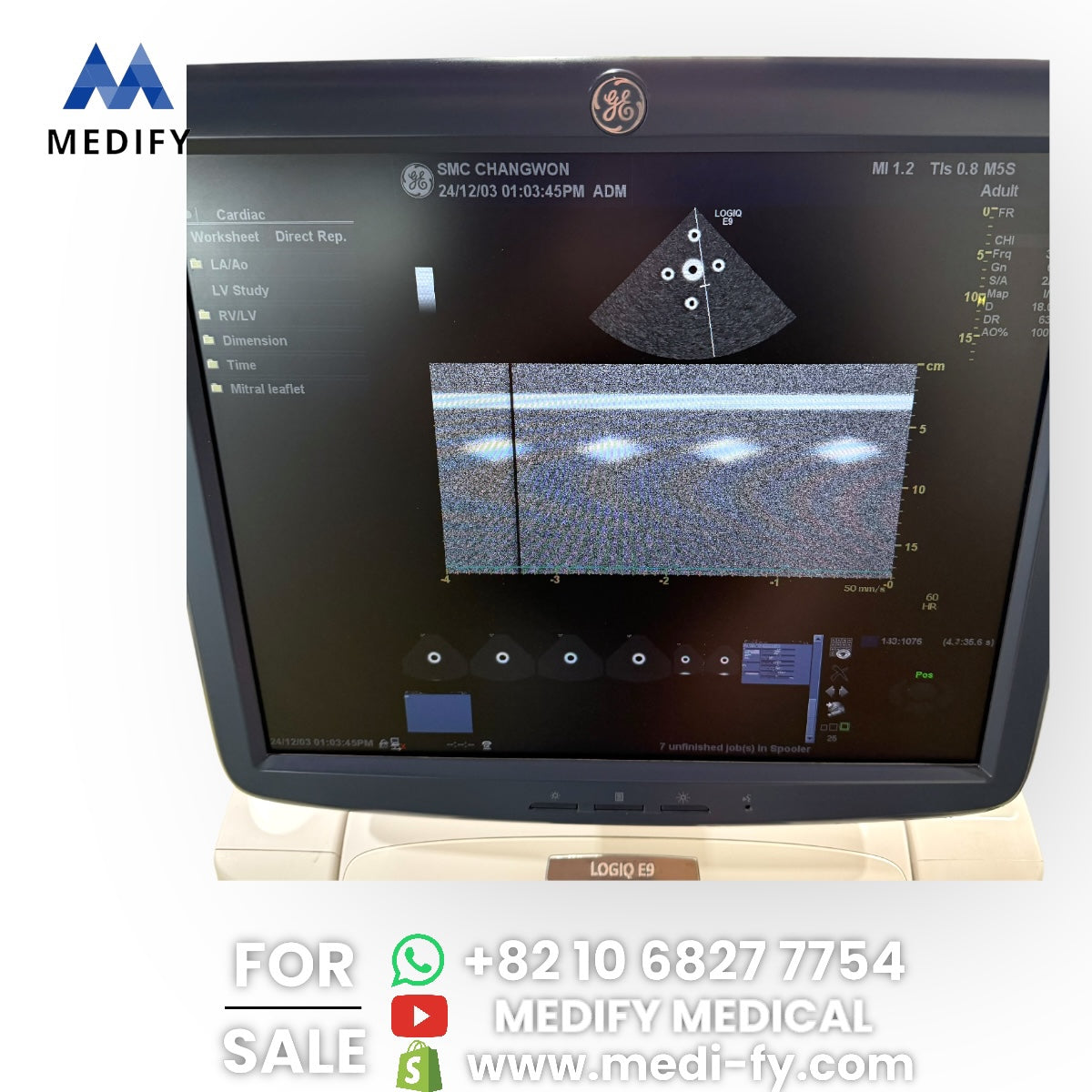 GE Logiq E9 Ultrasound System & 3Probes ( L8-18i, 9L, M4S) 3D/4D Software