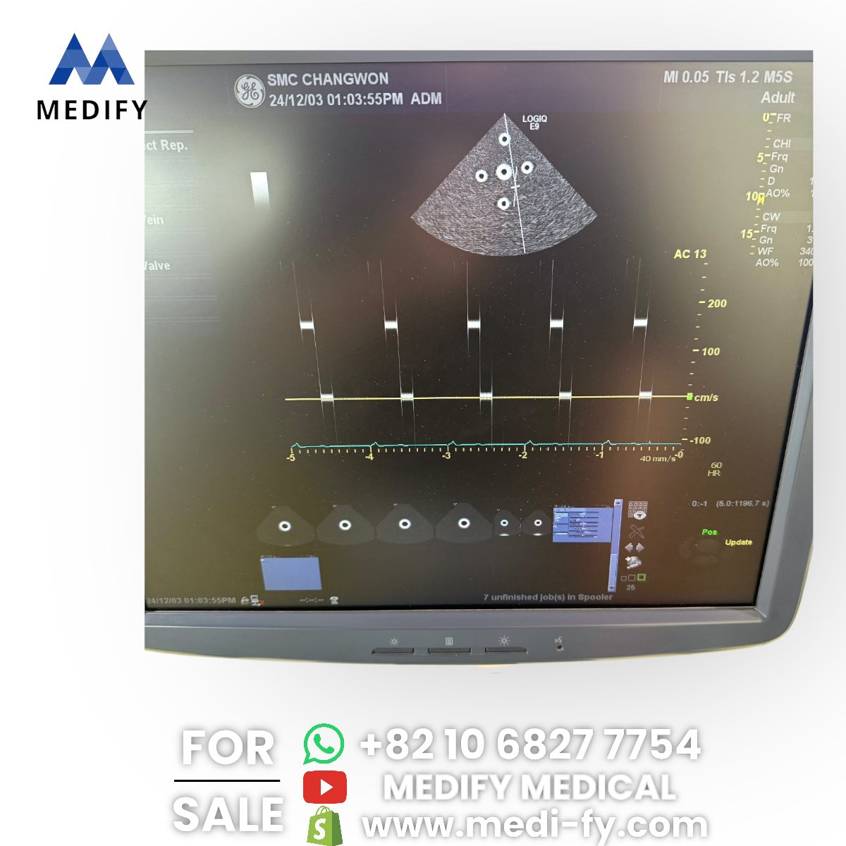 GE Logiq E9 Ultrasound System & 3Probes ( L8-18i, 9L, M4S) 3D/4D Software