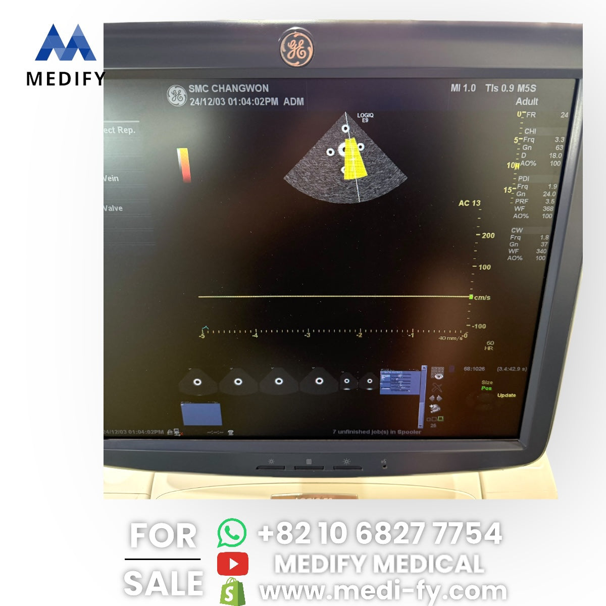 GE Logiq E9 Ultrasound System & 3Probes ( L8-18i, 9L, M4S) 3D/4D Software