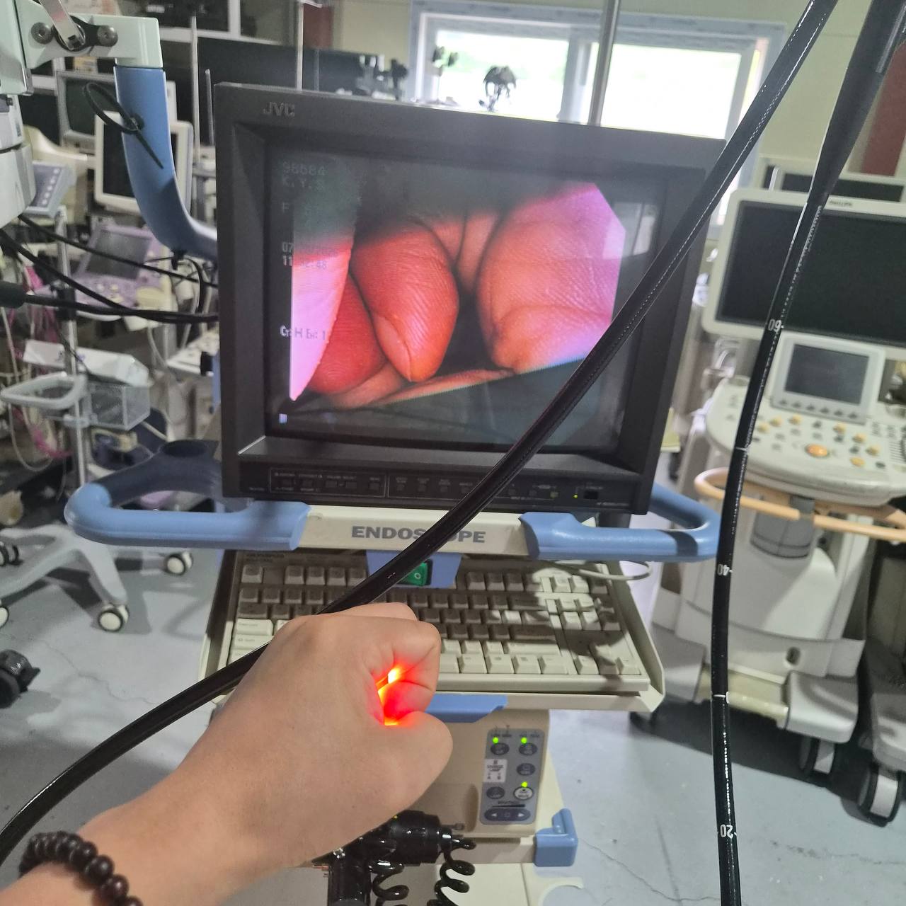 올림푸스 CV-150 프로세서 & GIF-Q150 & CF-Q150L Endoscopy System (GI Endoscope Set) - photo 1