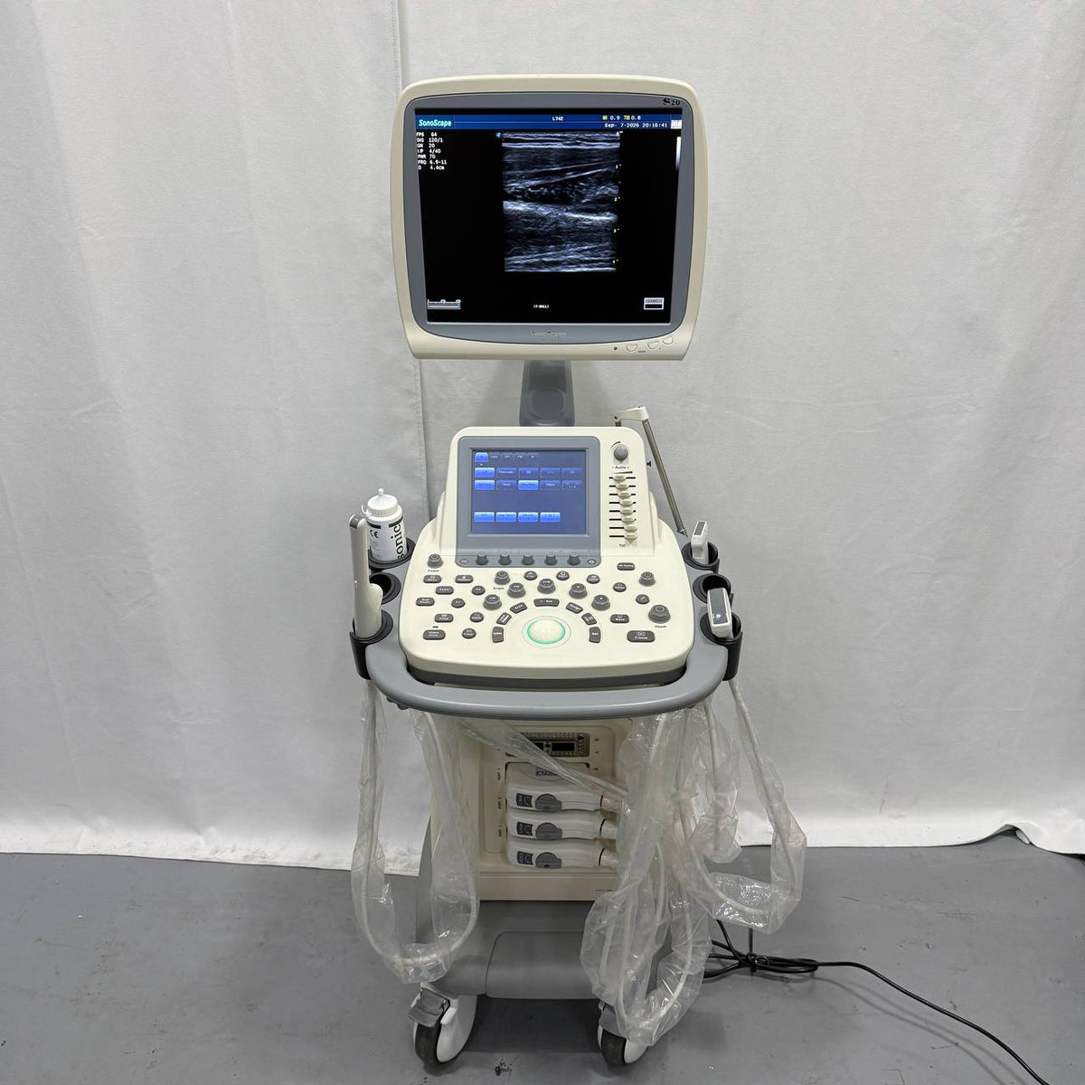 소노스케이프 S20 Ultrasound System - photo 1