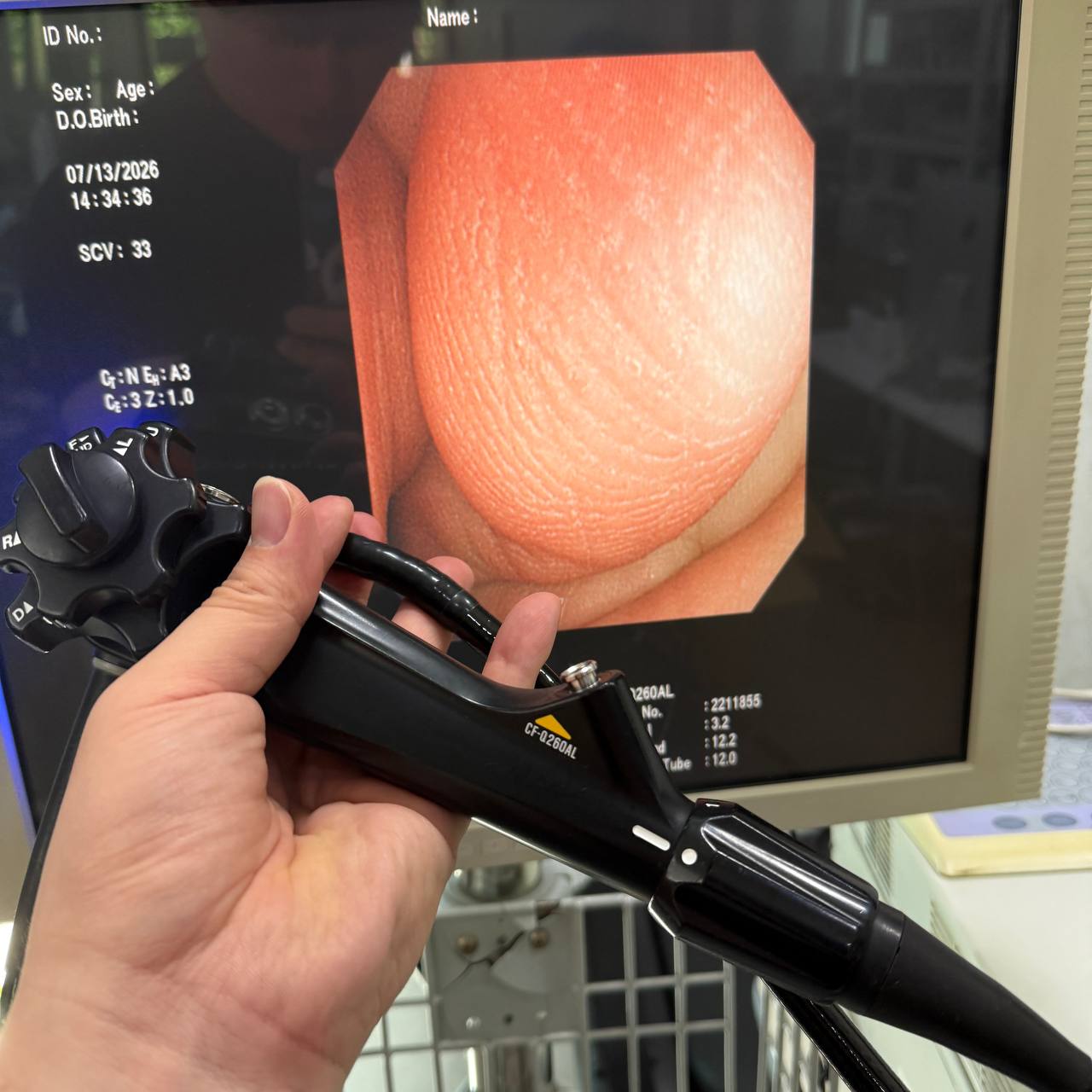 올림푸스 CF-Q260AL Colonoscope - photo 1