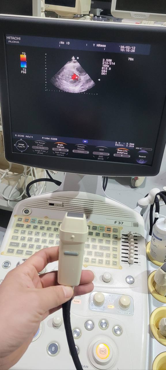 히타치 알로카 F37 Ultrasound System - photo 3
