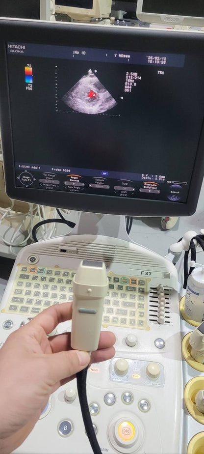 히타치 알로카 F37 Ultrasound System - photo 3
