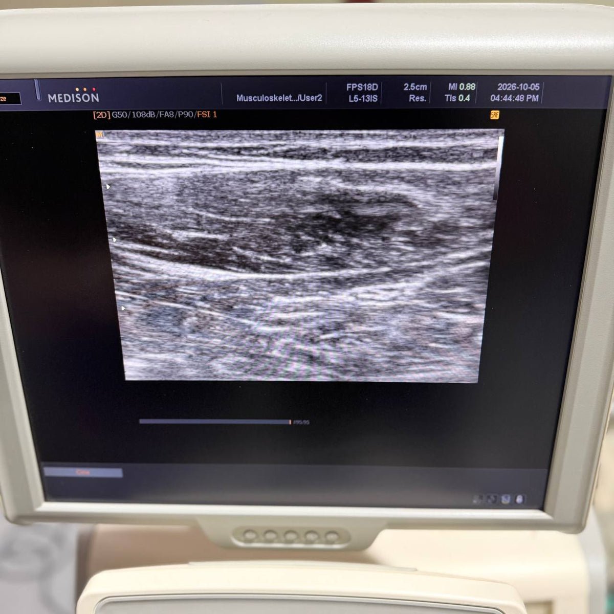 삼성메디슨 Accuvix V20 Ultrasound System - photo 4