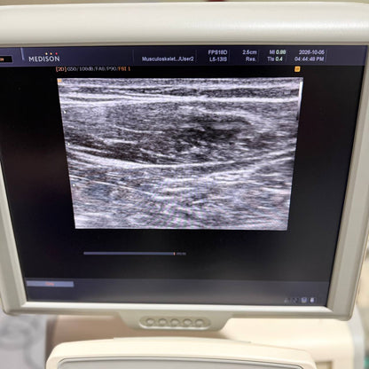 삼성메디슨 Accuvix V20 Ultrasound System - photo 4