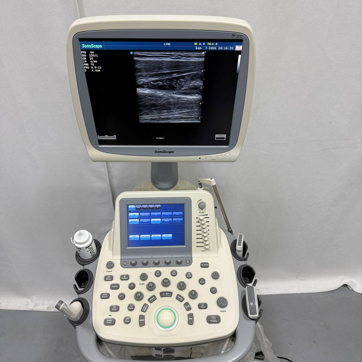 소노스케이프 S20 Ultrasound System - photo 4