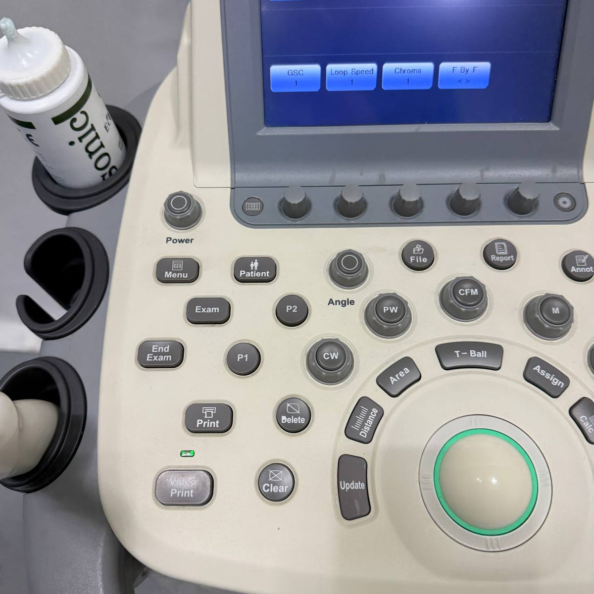 소노스케이프 S20 Ultrasound System - photo 5