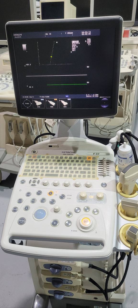 히타치 알로카 F37 Ultrasound System - photo 5