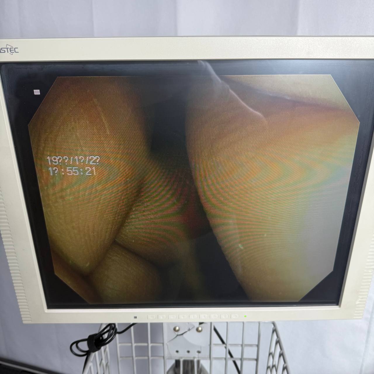 올림푸스 CF-V70 Colonoscope - photo 6