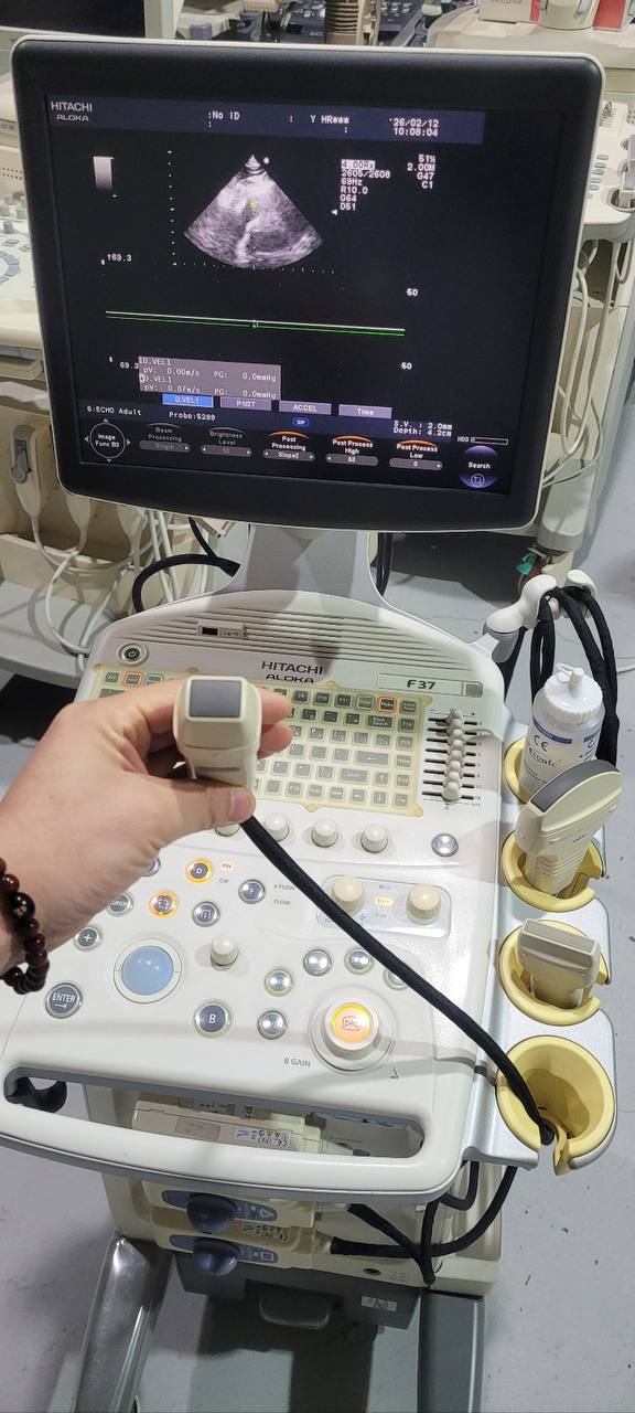 히타치 알로카 F37 Ultrasound System - photo 6