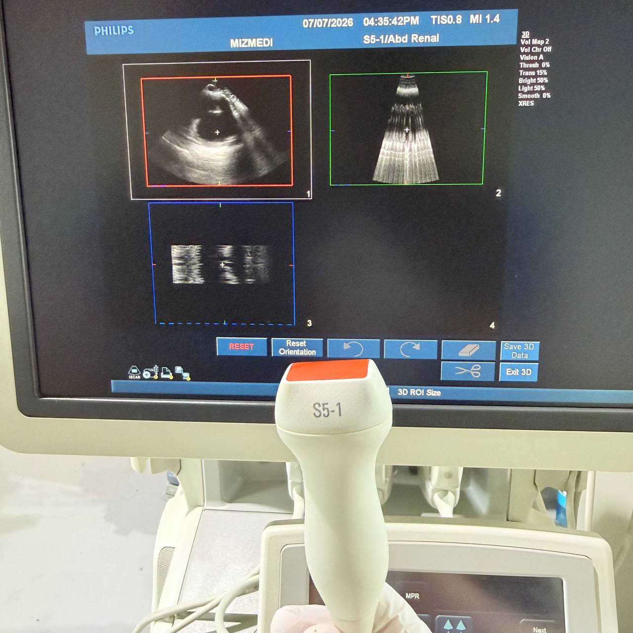 필립스 iU22 Ultrasound Machine - photo 7