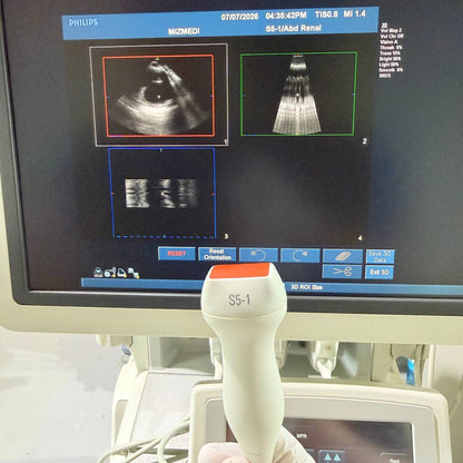필립스 iU22 Ultrasound Machine - photo 7
