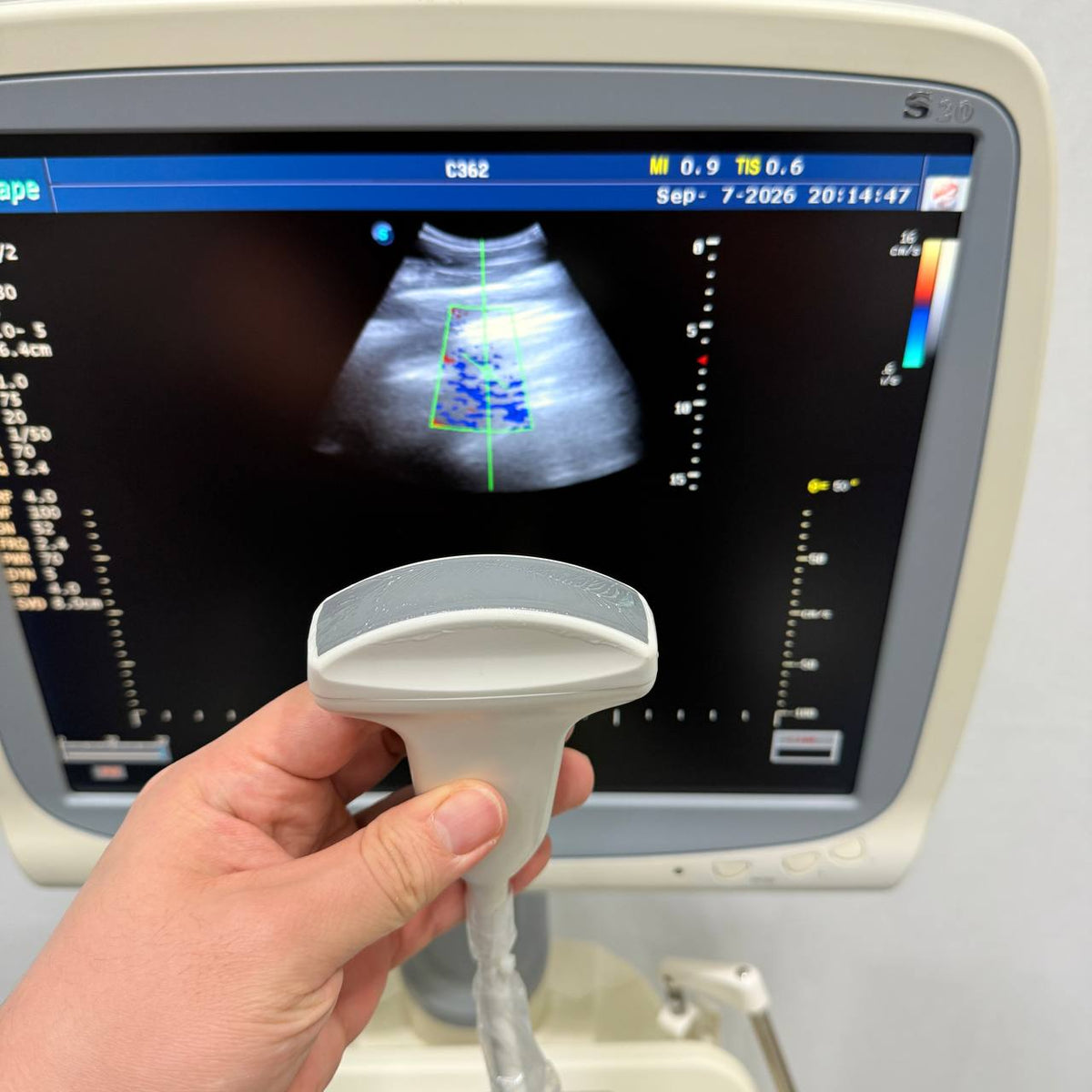 소노스케이프 S20 Ultrasound System - photo 7