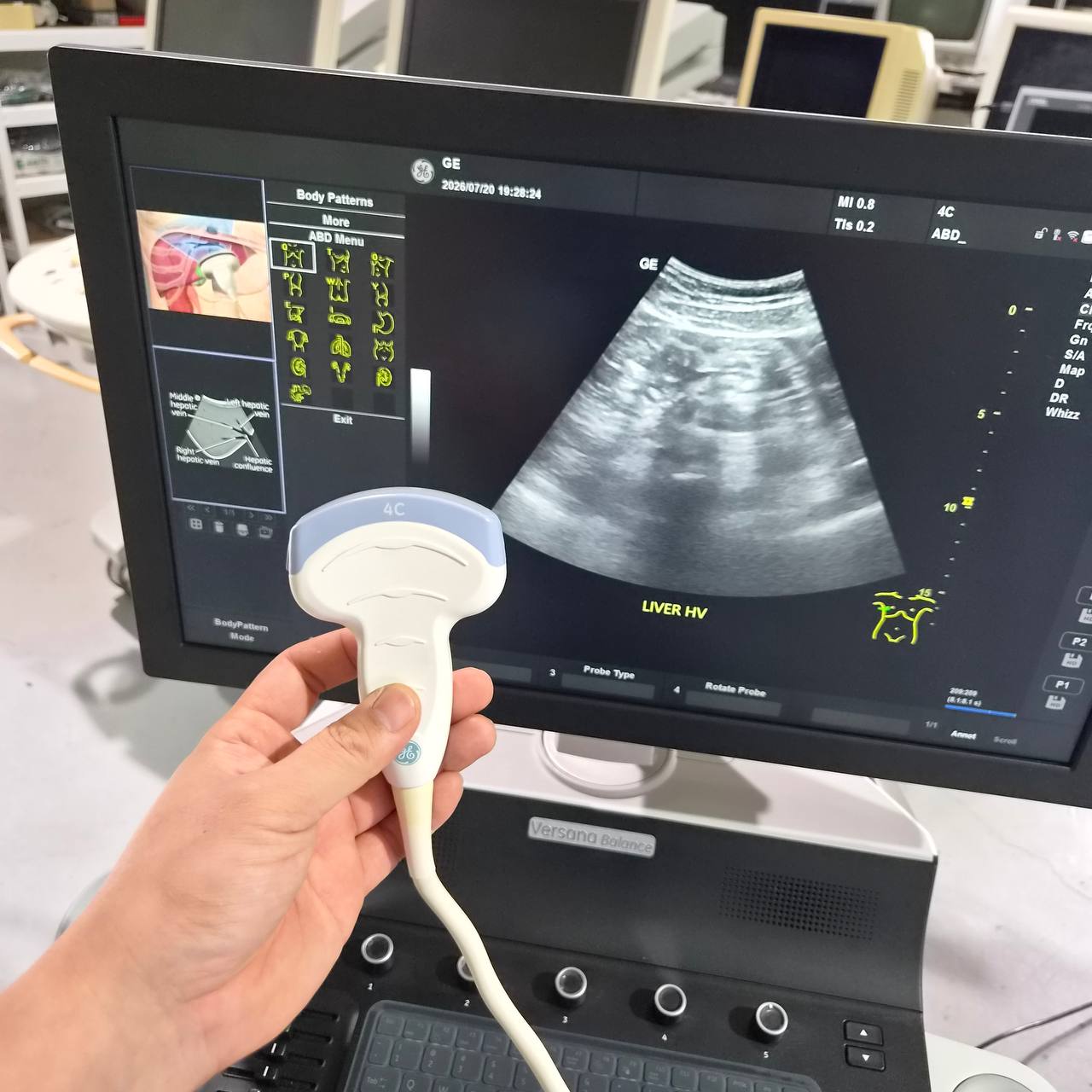 Used GE HealthCare Versana Balance (2021) Ultrasound Machine for Sale