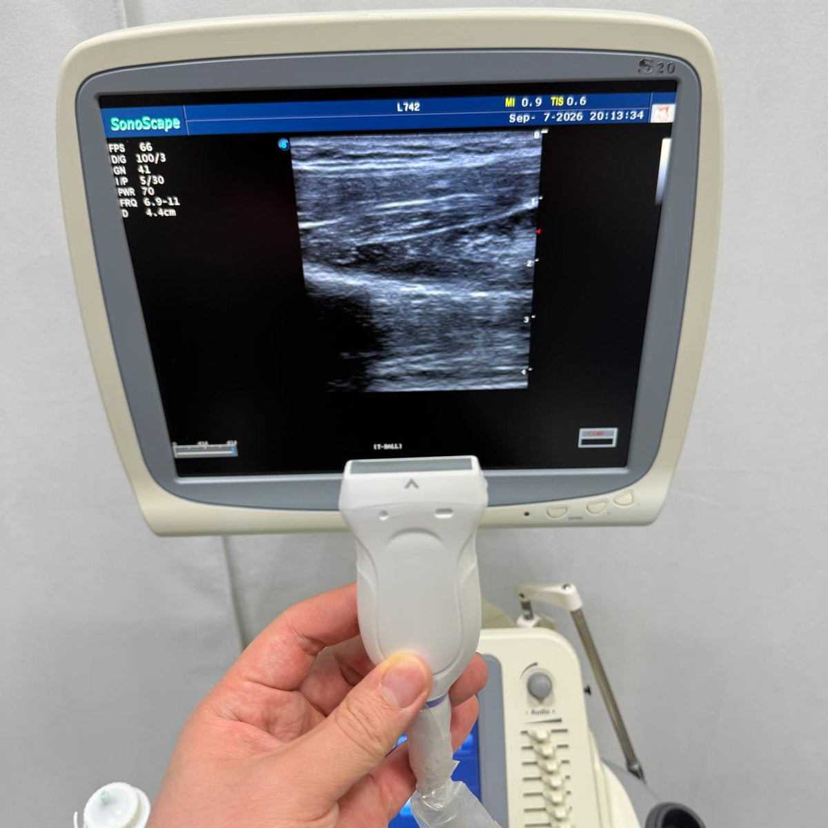 소노스케이프 S20 Ultrasound System - photo 8