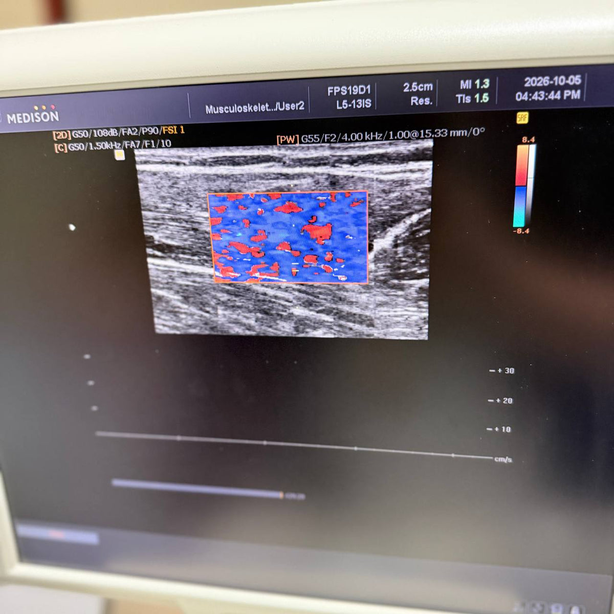 삼성메디슨 Accuvix V20 Ultrasound System - photo 8