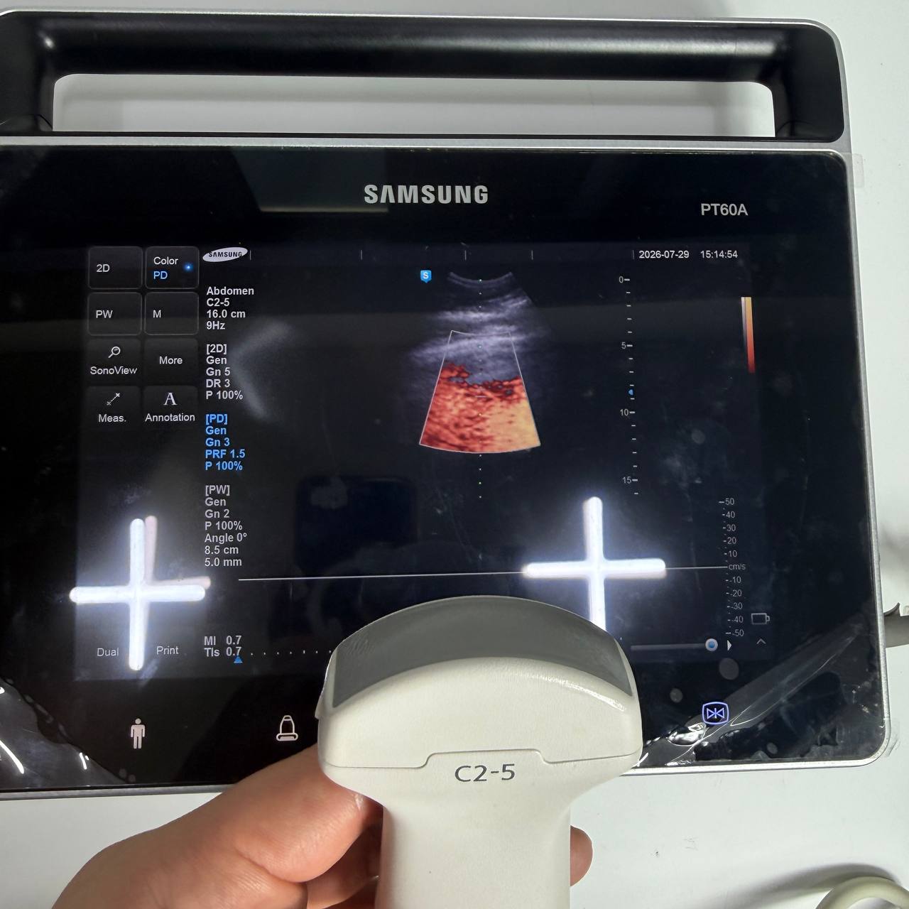삼성메디슨 PT60A Ultrasound System - photo 8