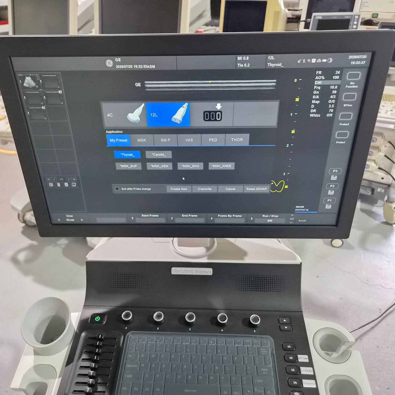 Used GE HealthCare Versana Balance (2021) Ultrasound Machine for Sale